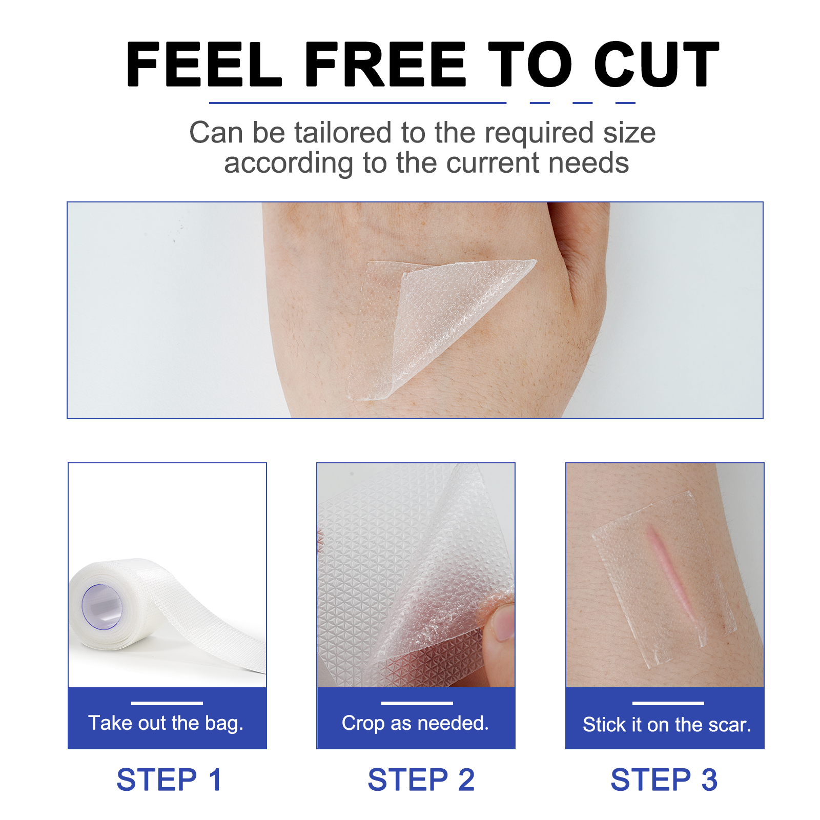 Waterproof Silicone Gel Scar Removal Roll – Customizable Treatment for Post-Surgery, Acne, and Stretch Marks