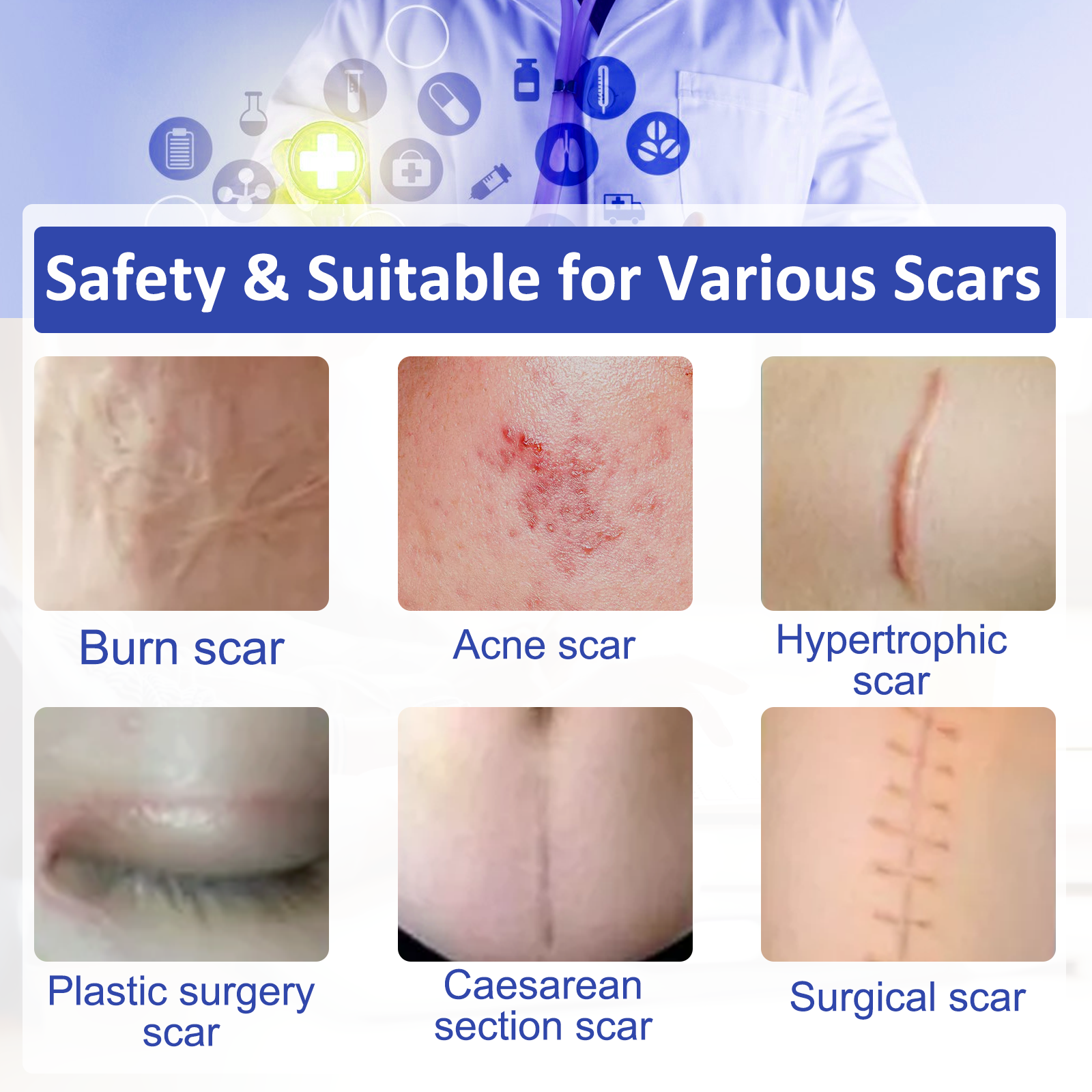 Waterproof Silicone Gel Scar Removal Roll – Customizable Treatment for Post-Surgery, Acne, and Stretch Marks